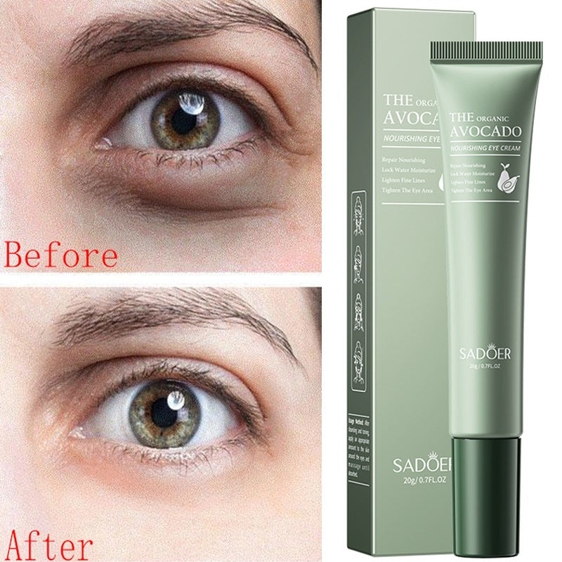 Eye cream for dark circles; green avocado-themed Sadoer packaging with before/after eye close-ups (3 items shown)