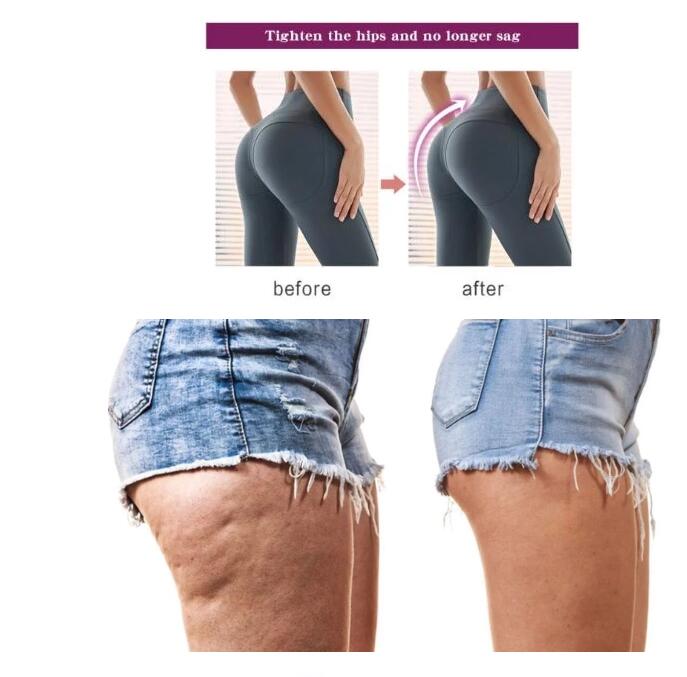 RtopR Body Cream for Buttocks Enhancement by Elixir-369; two-panel before/after images show smoother buttocks.