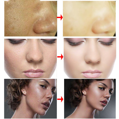 RtopR Moisturizing Cream collage: three before-and-after facial skin improvements