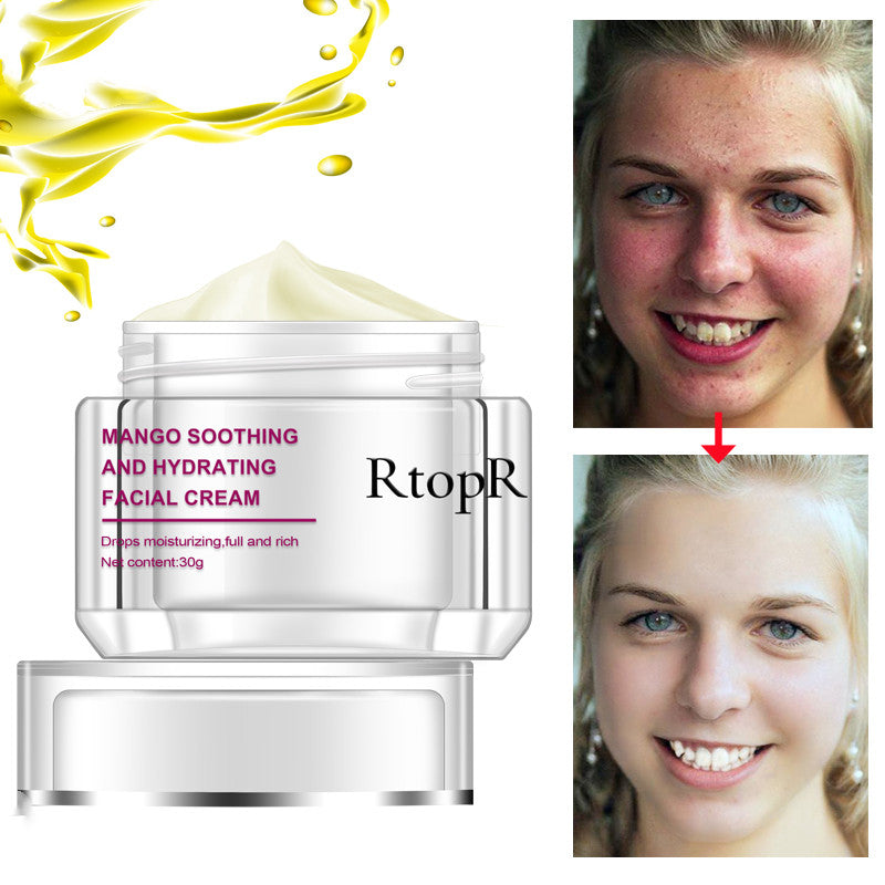 RtopR Mango Soothing Facial Cream in a silver jar with a yellow splash; Elixir-369 branding; before/after skin photo