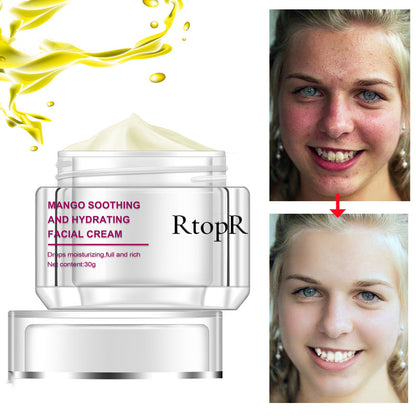 RtopR Mango Soothing Facial Cream in a silver jar with a yellow splash; Elixir-369 branding; before/after skin photo