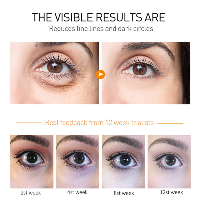 Eye Cream Elixir-369 ZENDROP for dark circles and puffiness; before/after closeups and 12-week results