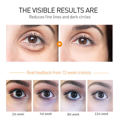Eye Cream Elixir-369 ZENDROP for dark circles and puffiness; before/after closeups and 12-week results