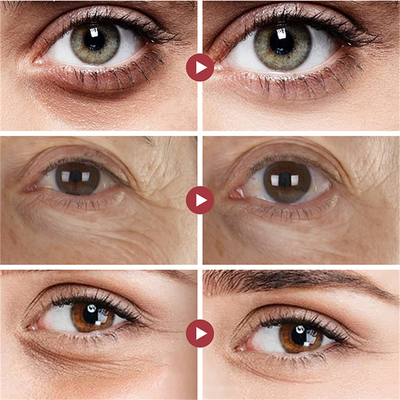 ZENDROP eye cream by Elixir-369 for dark circles, puffiness and fine lines
