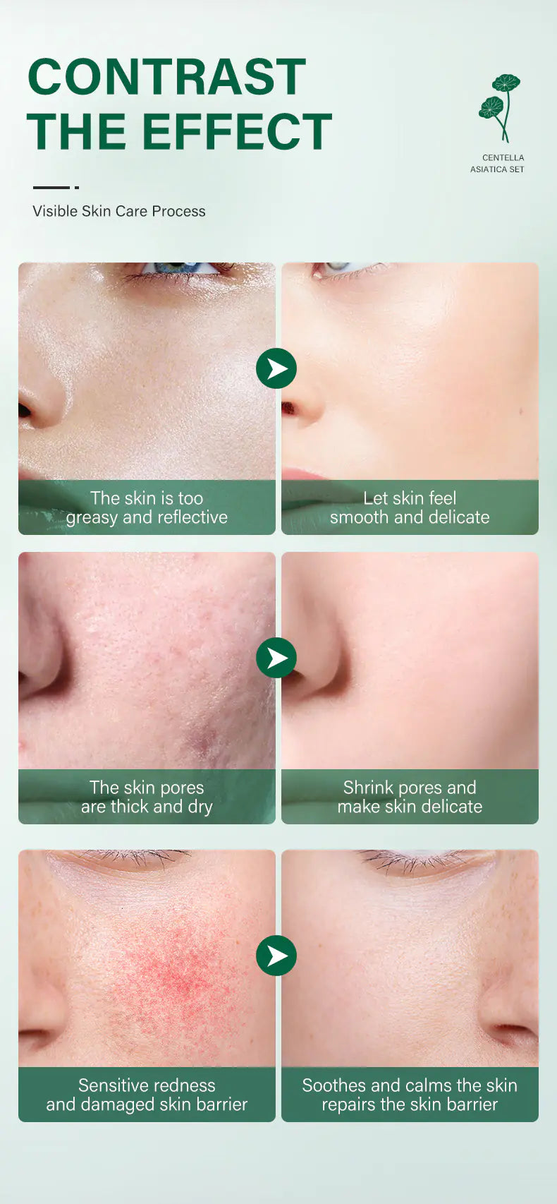 Private Label Skin Repair Centella Skin Care Kit Soothes Acne Face Care Centella Asiatica Extract Natural Facial Skin Care Set